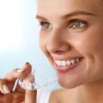Ebenso eine transparente Zahnschiene Ihre Zahnkorrektur rücksichtsvoll am unterstenützt