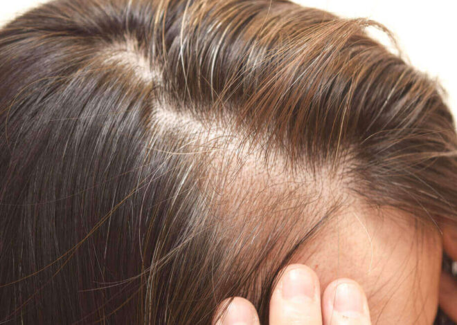 Haarausfall Ursachen